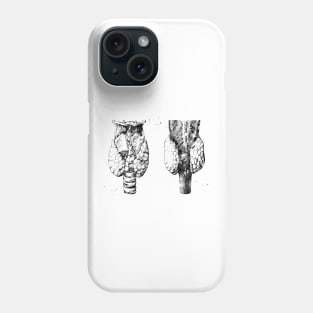 Anatomy of human thyroid gland Phone Case