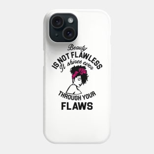 Beauty is not flawless it shines ever through your flaws Phone Case