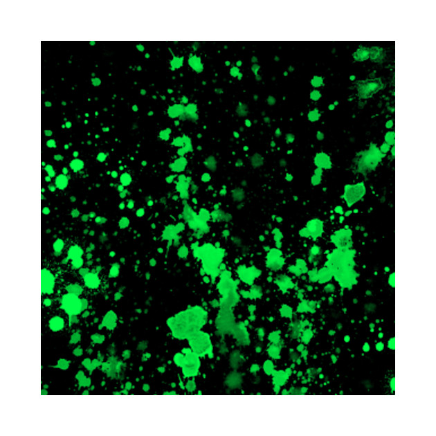 Modern Neon Green Splatter Paint - Splatter Paint - Phone Case