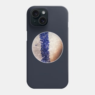 ballpoint pen in a microscope Phone Case