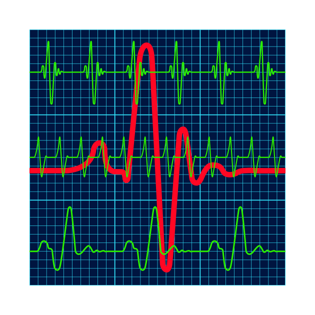 Cardiogram charts pattern by AlexanderZam