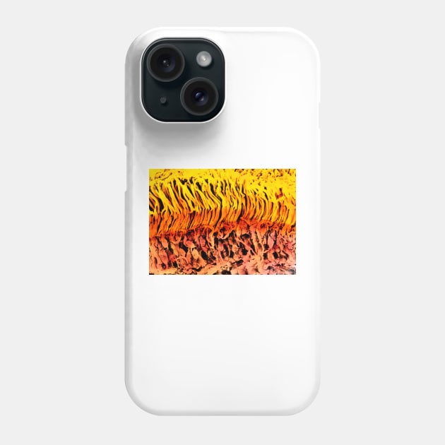 Coloured SEM of a section through the human retina (P424/0098) Phone Case by SciencePhoto