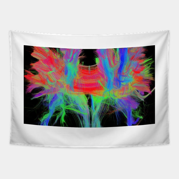 Corpus callosum, DTI MRI scan (C017/7044) Tapestry by SciencePhoto