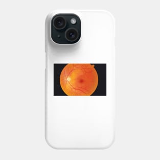 Healthy retina (P424/0175) Phone Case