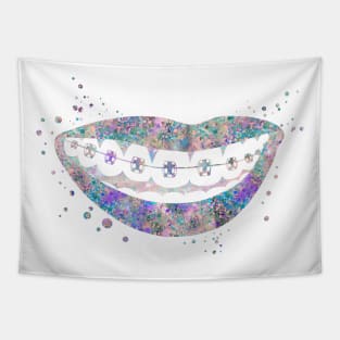 Teeth braces Tapestry