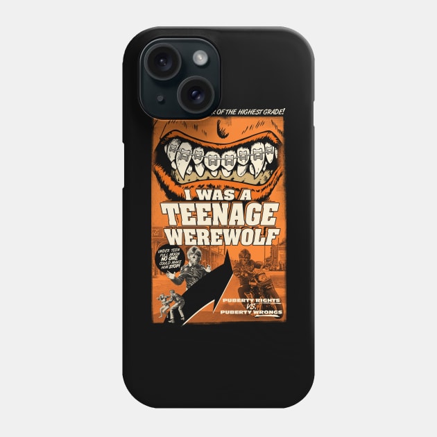 I Was a Teenage Werewolf Phone Case by UnlovelyFrankenstein