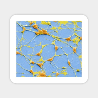 Pluripotent derived neurones, SEM, (C055/8975) Magnet