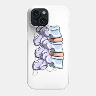 Lumbar Vertebrae Illustration Phone Case