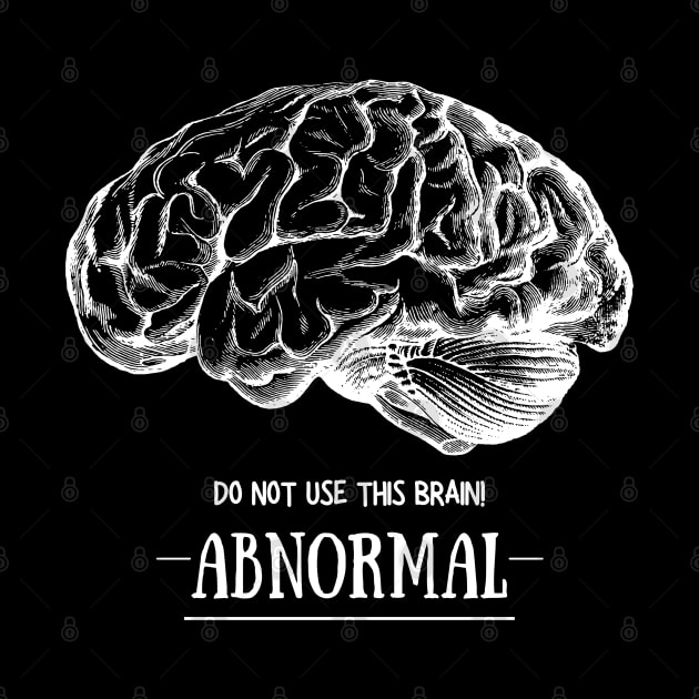 Young Frankenstein Abnormal Brain: White by Print Lilac