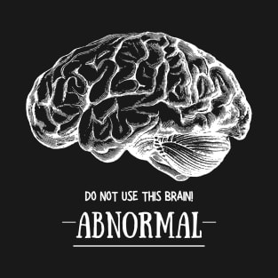 Young Frankenstein Abnormal Brain: White T-Shirt