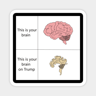 This is your brain on Trump Magnet