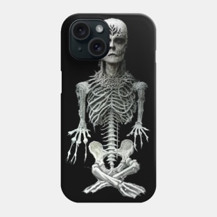 BlackMetal Homunculus Skeleton Artwork Phone Case