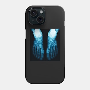 X-Ray Feet Phone Case