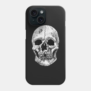 Skull Print - Anatomy Print - Skeleton Phone Case