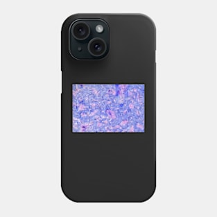 It's Purple, It's Pink, It's Abstract Phone Case