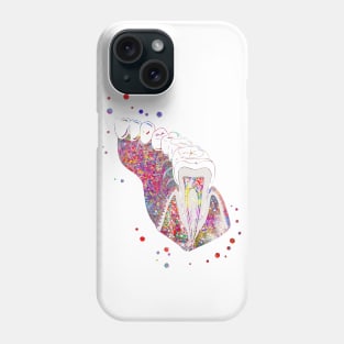 Molar tooth section Phone Case