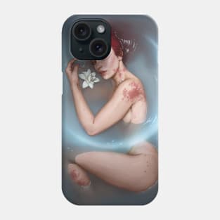 Cancer Phone Case