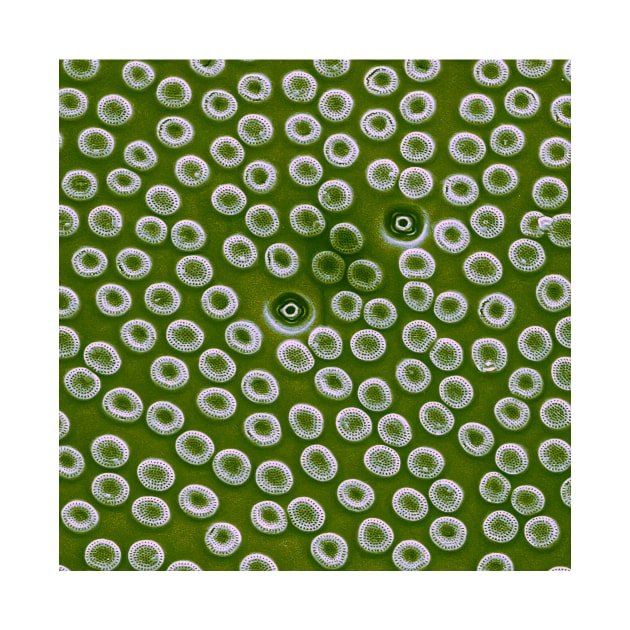 Diatom - Cyclostephanos from Lake Malawi (pea green) by DiatomsATTACK