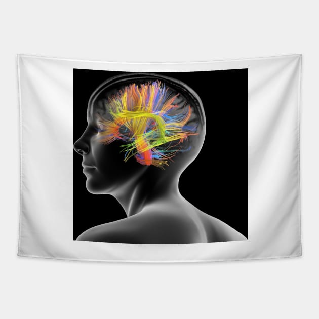 White matter fibres of the human brain (C020/9895) Tapestry by SciencePhoto