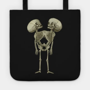 Siamese Twins Skeleton Tote