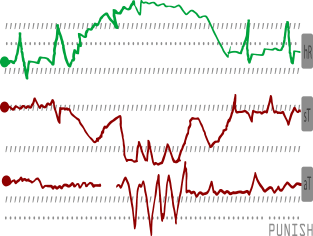 Punish EKG Magnet