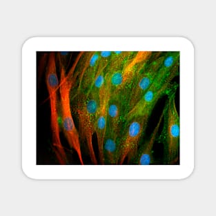 Adipose stem cells, light micrograph (C010/3069) Magnet