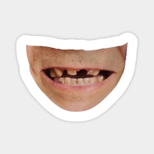 Funny Grinning Face With Bad Teeth Magnet