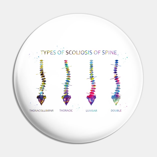 Type of scoliosis of spine Pin by erzebeth