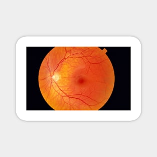 Healthy retina (P424/0175) Magnet