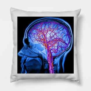 Vascular system of the brain, artwork (C024/6525) Pillow