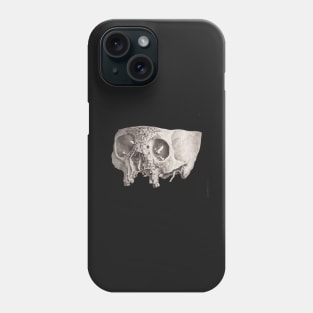 Diseased Skull, Unknown Phone Case