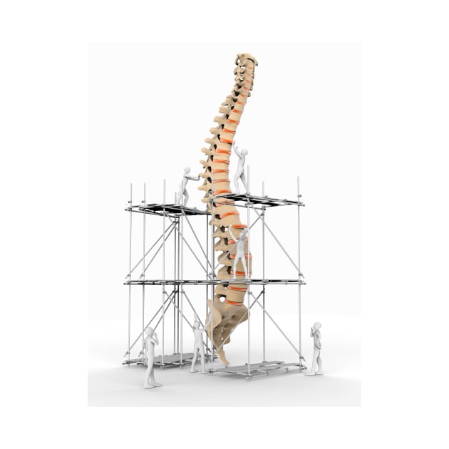 Spine with workers, spine repair (F007/9884) by SciencePhoto