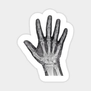 Radiologists Favorite X-ray Hand Magnet