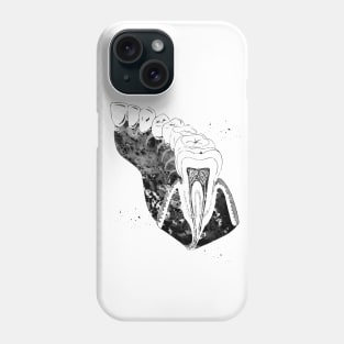 Molar Tooth Section Phone Case