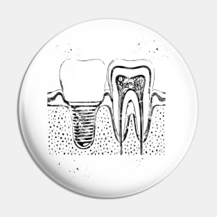 Human teeth and dental implant Pin