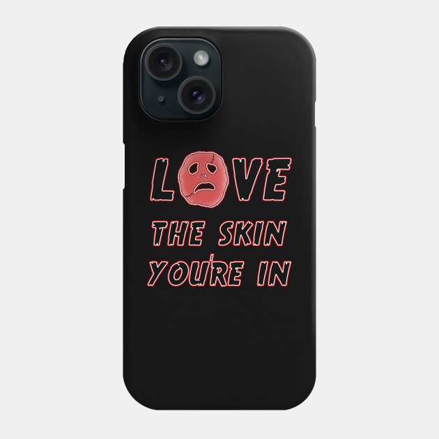 Love Skin Phone Case by FilthyAnimals