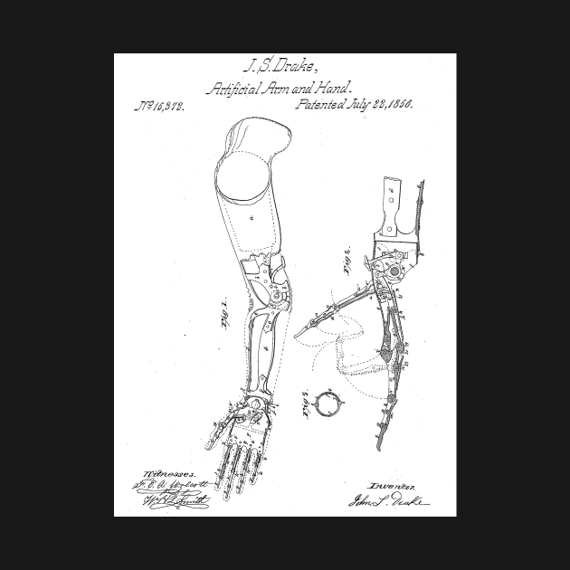 19th Century Prosthetic Arm by O&P Memes