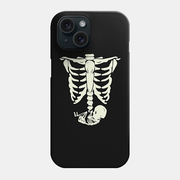 Pregnant X-Ray Phone Case by BamBam