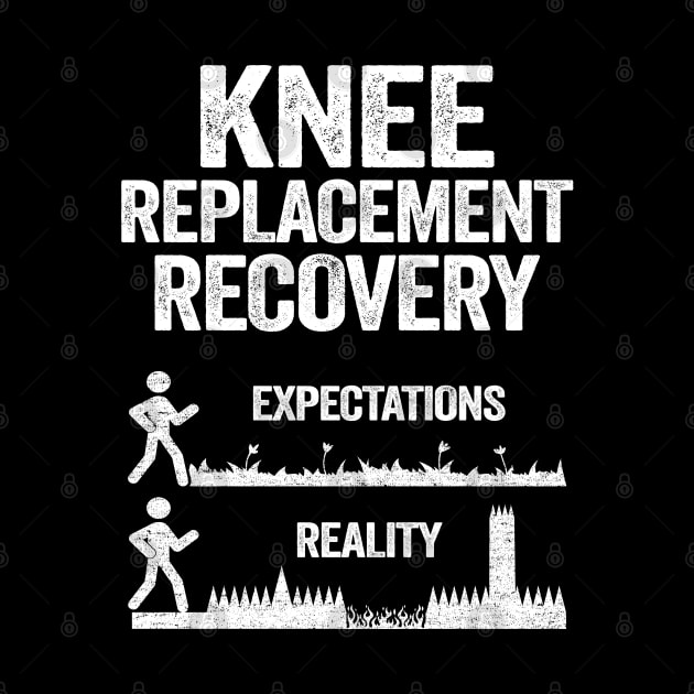 Funny Knee Replacement Surgery Recovery Expectations by Kuehni