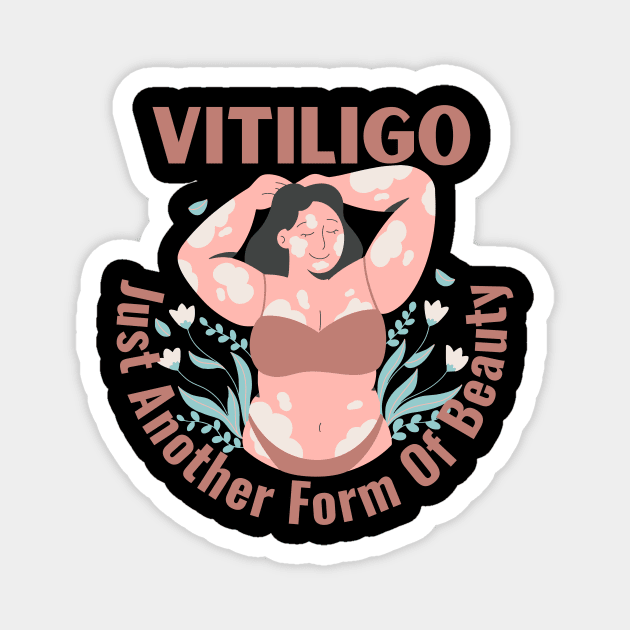 Vitiligo Just Another Form Of Beauty Female Model Magnet by Designs by Mim