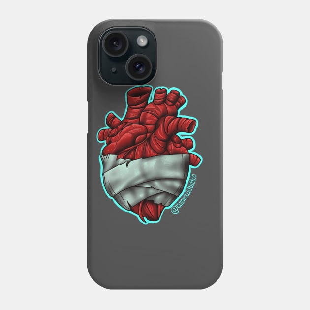 Wounded Phone Case by Timwould