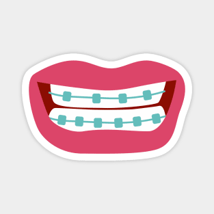 Woman smiling with teeth braces Magnet