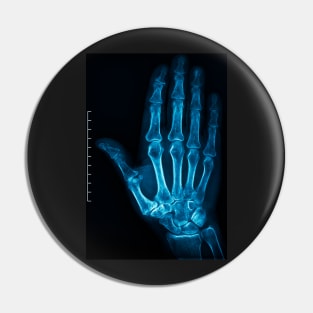 X-Ray Hand Pin