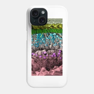 Retina of the eye, SEM (C026/4532) Phone Case