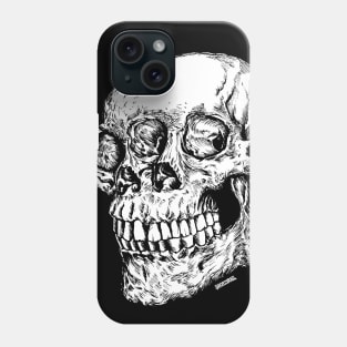 Skull King Phone Case