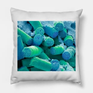 Soil diatoms, SEM, (C054/5526) Pillow