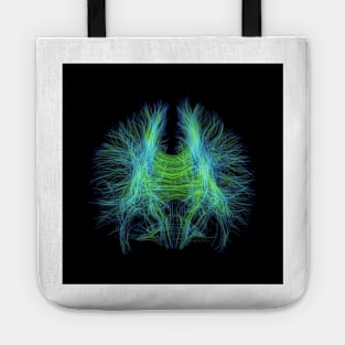 Brain fibres, DTI MRI scan (C017/7099) Tote