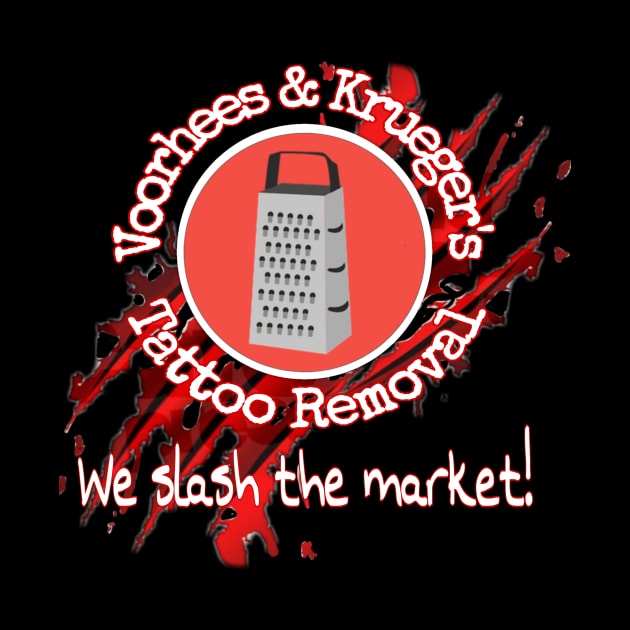 Tattoo removal by Retrostuff