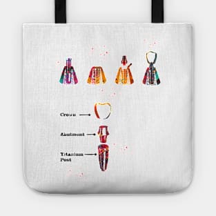 Dental implant procedure Tote