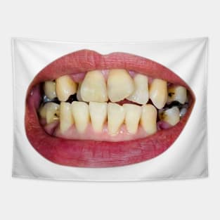 damaged teeth Tapestry